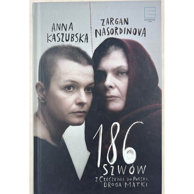 186 szwów z Czeczenii do Polski. Droga Matki