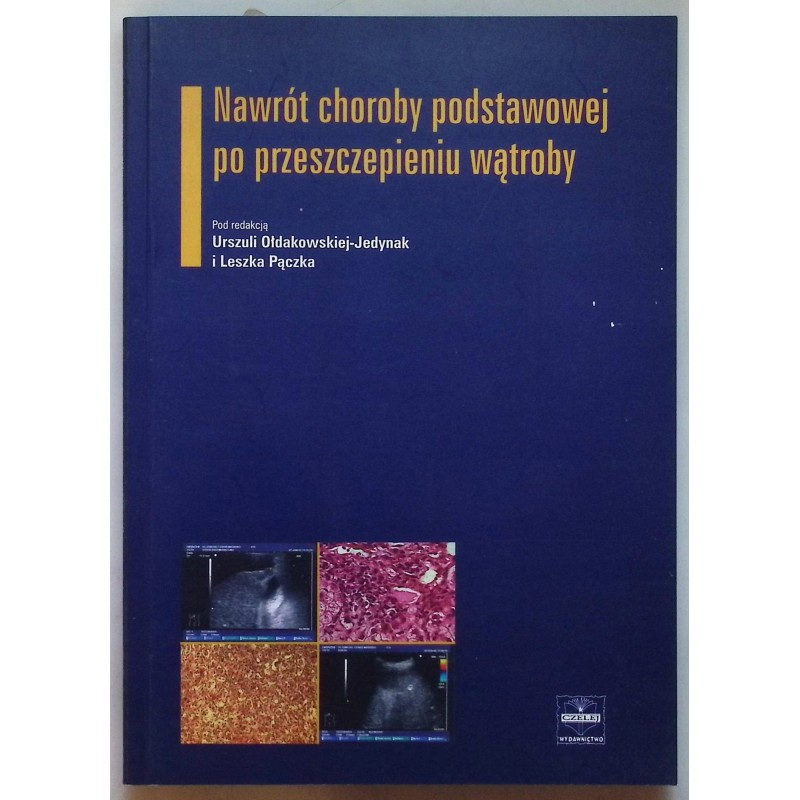 Nawrót choroby podstawowej po przeszczepieniu wątroby