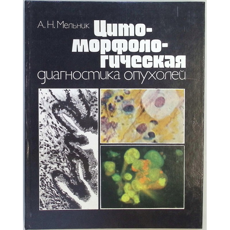 Cyto-Morfologiczna diagnostyka nowotworów Mielnik