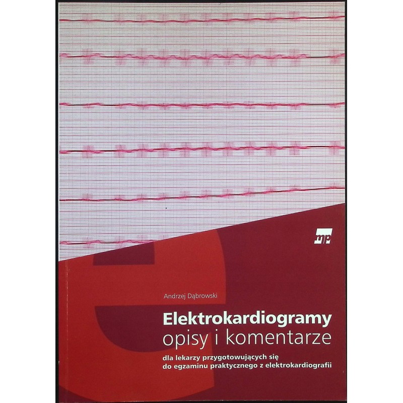 Elektrokardiogramy opisy i komentarze Andrzej Dąbrowski