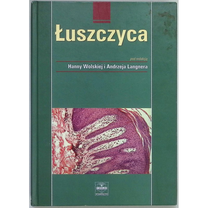 Łuszczyca Hanny Wolskiej i Andrzej Langnera