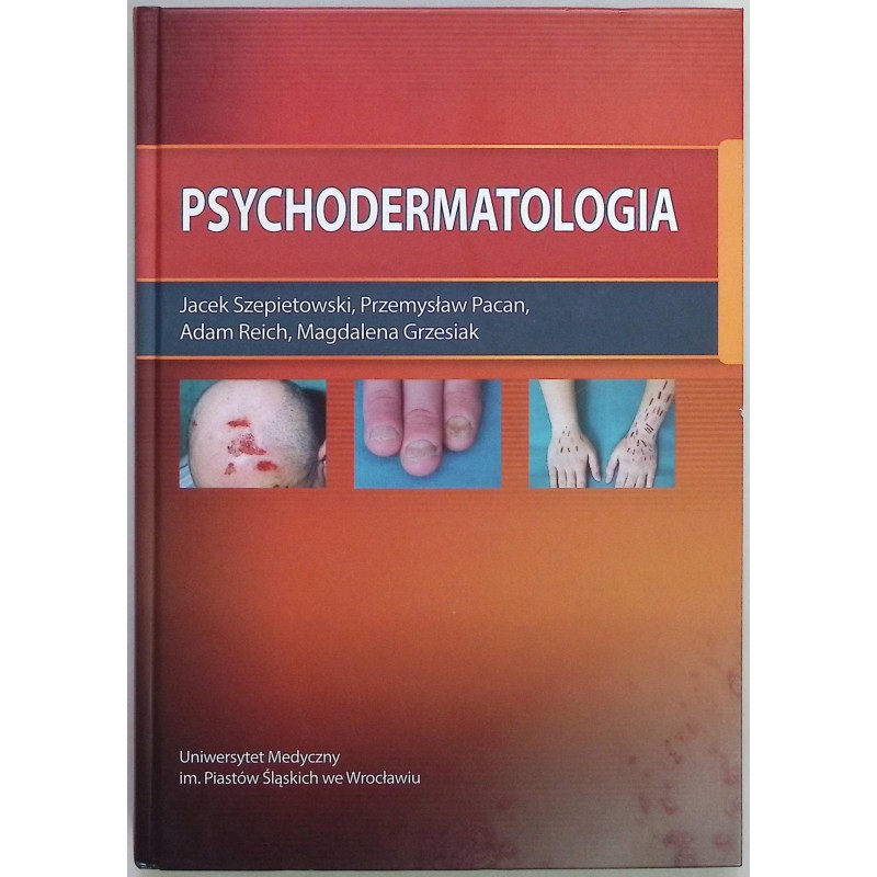 Psychodermatologia Jacek Szepietowski, Przemysław Pacan